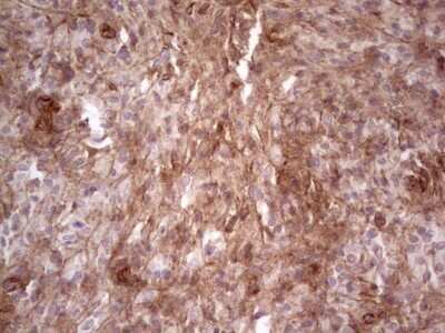 Immunohistochemistry: Laminin alpha 4 Antibody (OTI5G8) - Azide and BSA Free [NBP2-71113]