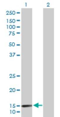 Western Blot: Laminin alpha 4 Antibody [H00003910-D01P]