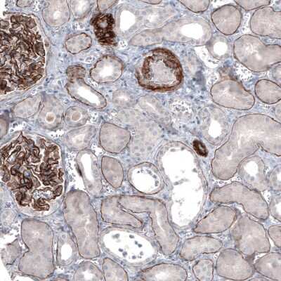 Immunohistochemistry-Paraffin: Laminin alpha 5 Antibody (CL3118) [NBP2-42391]
