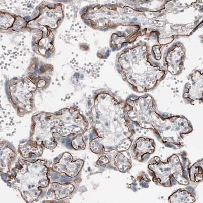 Immunohistochemistry-Paraffin: Laminin alpha 5 Antibody (CL3118) [NBP2-42391]