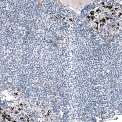 Immunohistochemistry-Paraffin: Laminin alpha 5 Antibody (CL3118) [NBP2-42391]