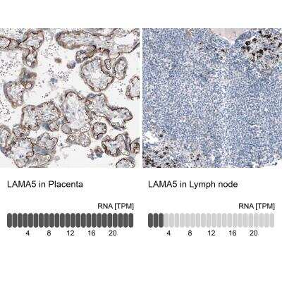 Immunohistochemistry-Paraffin: Laminin alpha 5 Antibody (CL3118) [NBP2-42391]