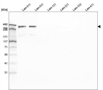 Western Blot: Laminin alpha 5 Antibody (CL3118) [NBP2-42391]