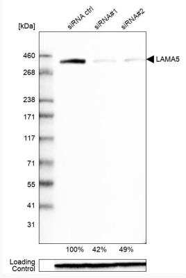 Western Blot: Laminin alpha 5 Antibody (CL3118) [NBP2-42391]
