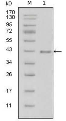 Western Blot: Laminin beta 1 Antibody (2D9G5)BSA Free [NBP1-51558]