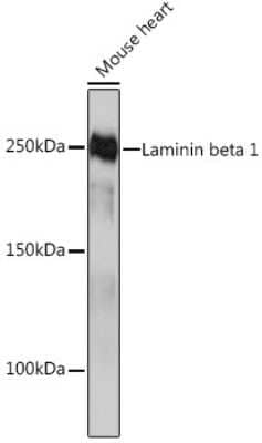 Western Blot: Laminin beta 1 Antibody (6I9T4) [NBP3-16392]