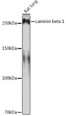 Western Blot: Laminin beta 1 Antibody (6I9T4) [NBP3-16392]