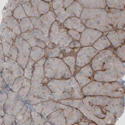 Immunohistochemistry-Paraffin: Laminin beta 1 Antibody (CL2970) [NBP2-42385]