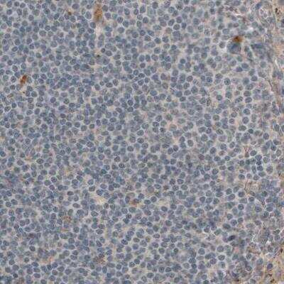 Immunohistochemistry-Paraffin: Laminin beta 1 Antibody (CL2970) [NBP2-42385]
