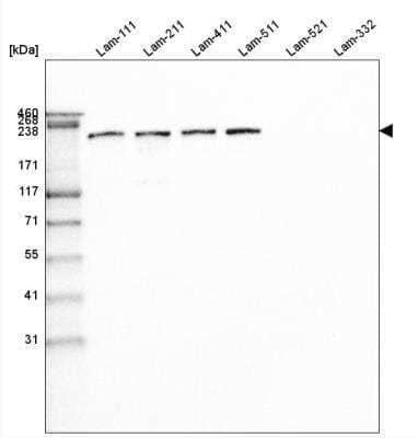 Western Blot: Laminin beta 1 Antibody (CL2970) [NBP2-42385]