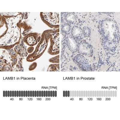 Immunohistochemistry-Paraffin: Laminin beta 1 Antibody [NBP1-88073]