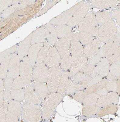 Immunohistochemistry-Paraffin: Laminin beta 1 Antibody [NBP1-88074]