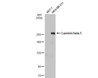 Western Blot: Laminin beta 1 Antibody [NBP1-32043]