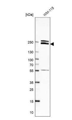 Western Blot: Laminin beta 1 Antibody [NBP1-88074]