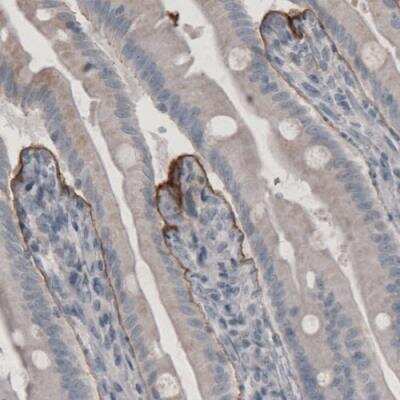 Immunohistochemistry-Paraffin: Laminin beta 3 Antibody (CL3363) [NBP2-46623]