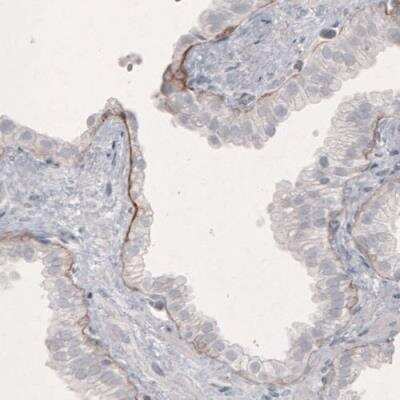 Immunohistochemistry-Paraffin: Laminin beta 3 Antibody (CL3363) [NBP2-46623]