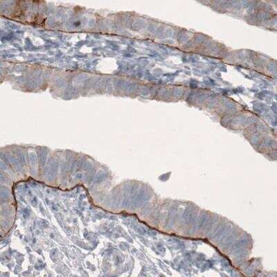 Immunohistochemistry-Paraffin: Laminin beta 3 Antibody (CL3363) [NBP2-46623]