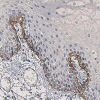 Immunohistochemistry-Paraffin: Laminin beta 3 Antibody (CL3363) [NBP2-46623]