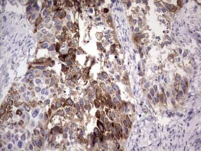Immunohistochemistry: Laminin beta 3 Antibody (OTI3A2) [NBP2-45596]
