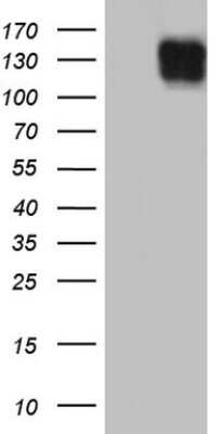 Western Blot: Laminin beta 3 Antibody (OTI8H5) [NBP2-45597]