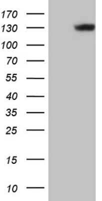 Western Blot: Laminin beta 3 Antibody (OTI9G3) [NBP2-45598]