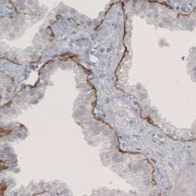 Immunohistochemistry-Paraffin: Laminin beta 3 Antibody (CL3353) [NBP2-46622]