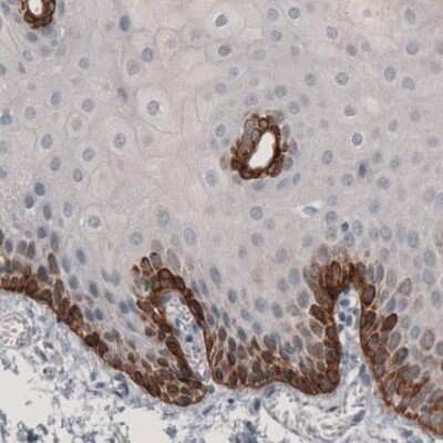 Immunohistochemistry-Paraffin: Laminin beta 3 Antibody (CL3353) [NBP2-46622]