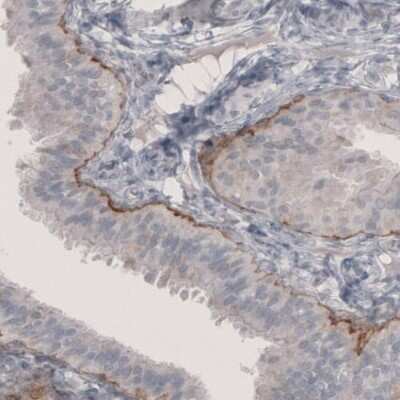 Immunohistochemistry-Paraffin: Laminin beta 3 Antibody (CL3353) [NBP2-46622]