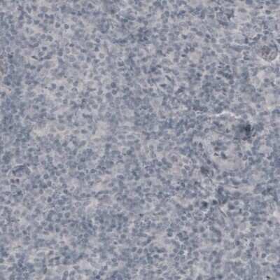 Immunohistochemistry-Paraffin: Laminin beta 3 Antibody (CL3353) [NBP2-46622]