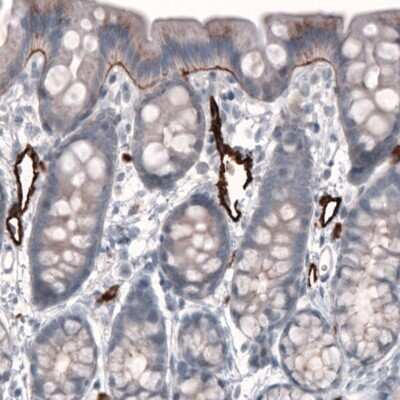 Immunohistochemistry-Paraffin: Laminin beta 3 Antibody (CL3353) [NBP2-46622]