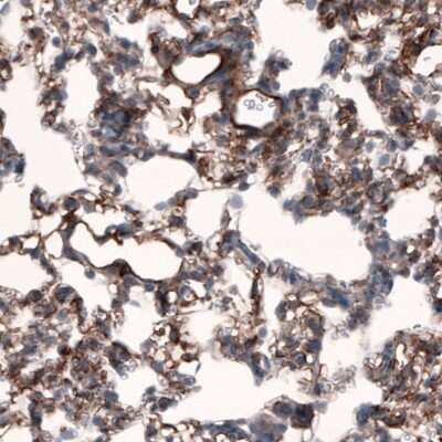 Immunohistochemistry-Paraffin: Laminin beta 3 Antibody (CL3353) [NBP2-46622]