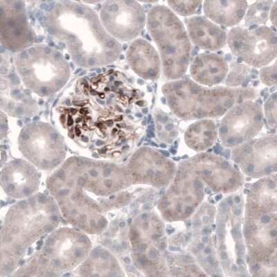 Immunohistochemistry-Paraffin: Laminin beta 3 Antibody (CL3353) [NBP2-46622]