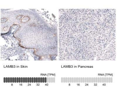 Immunohistochemistry-Paraffin: Laminin beta 3 Antibody (CL3353) [NBP2-46622]