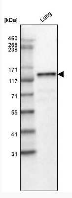 Western Blot: Laminin beta 3 Antibody (CL3353) [NBP2-46622]