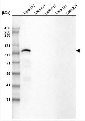 Western Blot: Laminin beta 3 Antibody (CL3353) [NBP2-46622]
