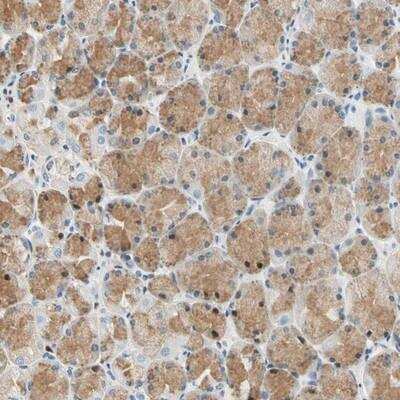 Immunohistochemistry-Paraffin: Laminin beta 3 Antibody [NBP1-89956]