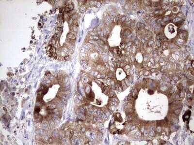 Immunohistochemistry: Laminin beta 3 Antibody (OTI3A2) - Azide and BSA Free [NBP2-71115]
