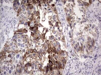 Immunohistochemistry: Laminin beta 3 Antibody (OTI3A2) - Azide and BSA Free [NBP2-71115]