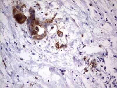 Immunohistochemistry: Laminin beta 3 Antibody (OTI3A2) - Azide and BSA Free [NBP2-71115]