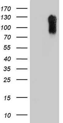 Western Blot: Laminin beta 3 Antibody (OTI3A2)Azide and BSA Free [NBP2-71115]