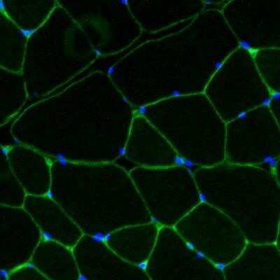 Immunocytochemistry/ Immunofluorescence: Laminin gamma 1 Antibody (A5) - Azide and BSA Free [NBP2-47842]