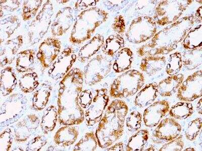 Immunohistochemistry-Paraffin: Laminin gamma 1 Antibody (A5) - IHC-Prediluted [NBP2-48357]