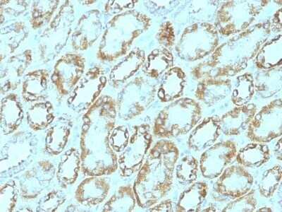 Immunohistochemistry-Paraffin: Laminin gamma 1 Antibody (A5) - IHC-Prediluted [NBP2-48357]