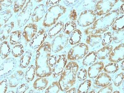 Immunohistochemistry-Paraffin: Laminin gamma 1 Antibody (A5) [NBP2-44751]