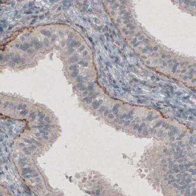 Immunohistochemistry-Paraffin: Laminin gamma 1 Antibody (CL3195) [NBP2-42394]