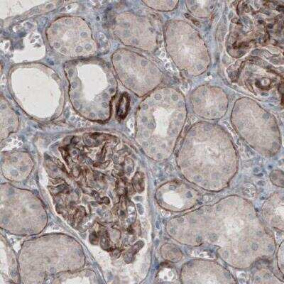 Immunohistochemistry-Paraffin: Laminin gamma 1 Antibody (CL3195) [NBP2-42394]