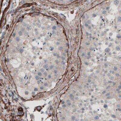 Immunohistochemistry-Paraffin: Laminin gamma 1 Antibody (CL3195) [NBP2-42394]