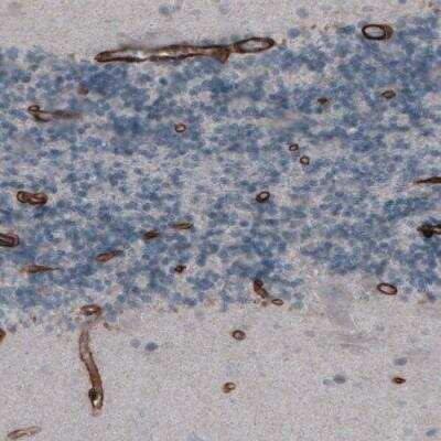 Immunohistochemistry-Paraffin: Laminin gamma 1 Antibody (CL3195) [NBP2-42394]