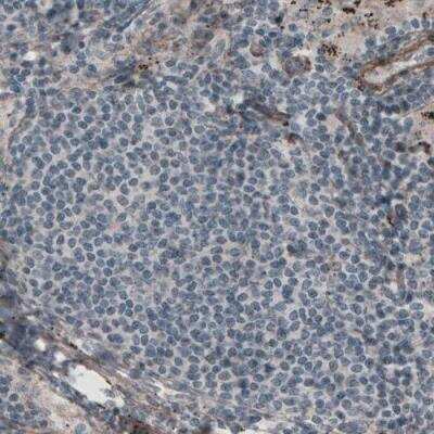 Immunohistochemistry-Paraffin: Laminin gamma 1 Antibody (CL3195) [NBP2-42394]