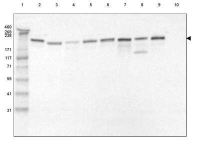 Western Blot: Laminin gamma 1 Antibody (CL3195) [NBP2-42394]